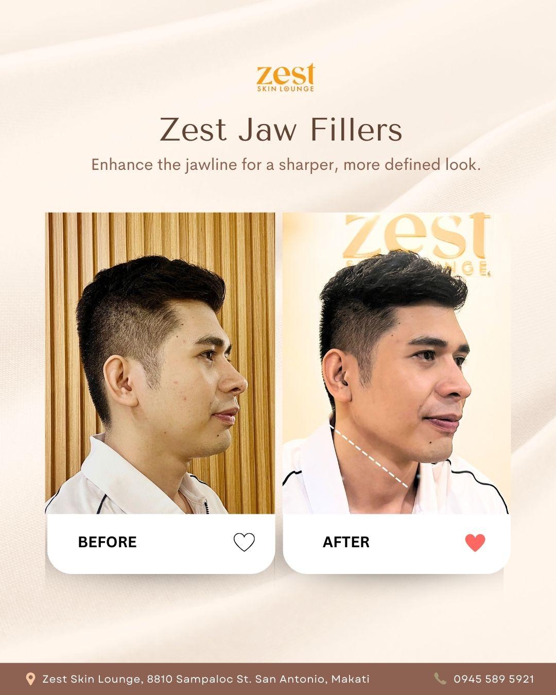 Zest Skin Lounge — photo 9