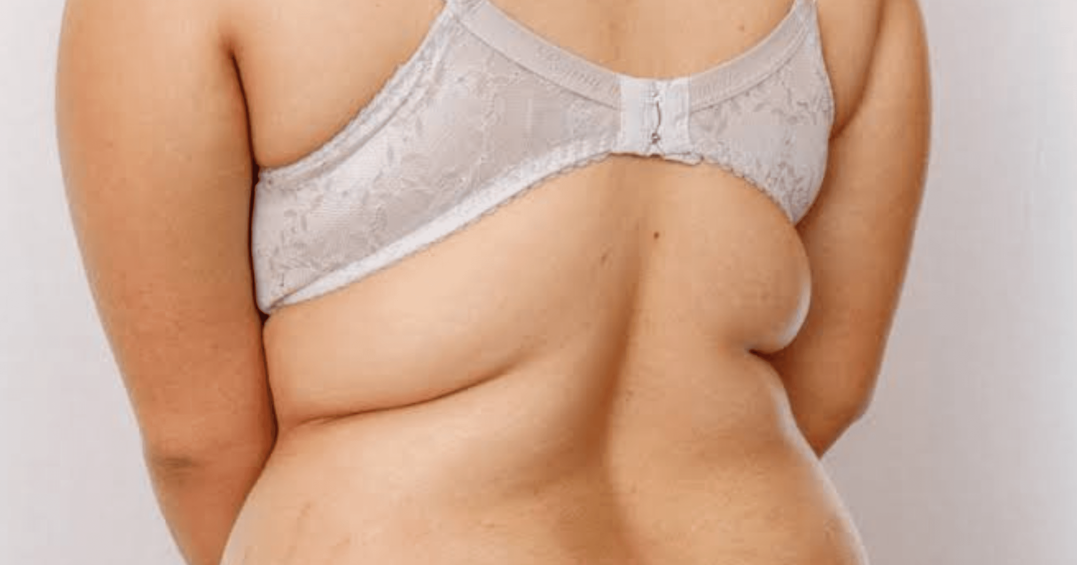 Adipolysis Non-Surgical Lipo: Whole Body Fat Removal
