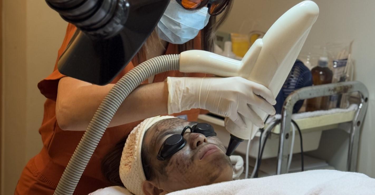 Carbon Laser Peel + Diamond Peel + Glycolic Cleaning