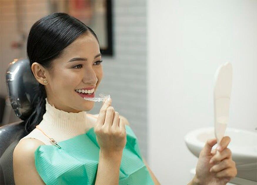 Clear Aligners + FREE Retainers Package (Arrasmile)