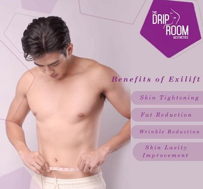 Exilift Body Contouring: Skin Tightening + Fat Reduction