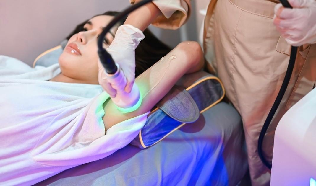 Cryolipolysis Fat Freezing, Permanent Fat Loss