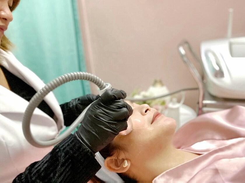 RF Face Lift + Contouring, Non-Invasive, 1 Session