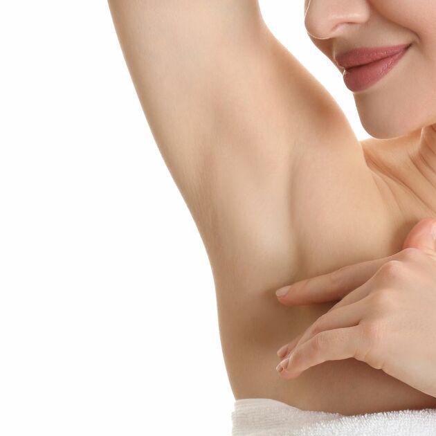 Underarm Clarifying Carbon Peel, 4 Sessions