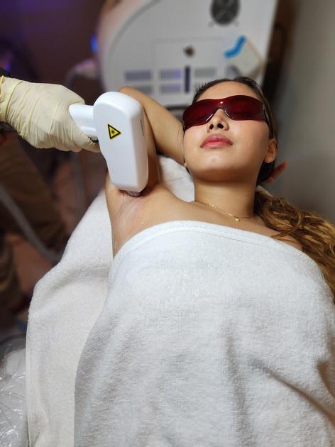 Underarm Diode Laser Hair Removal, 1 Session