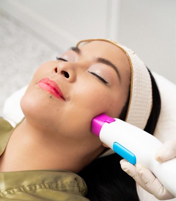 Thermaface RF Skin Tightening: Half Face