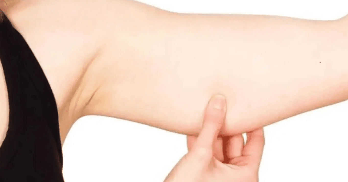 Strip Shape- Upperarm