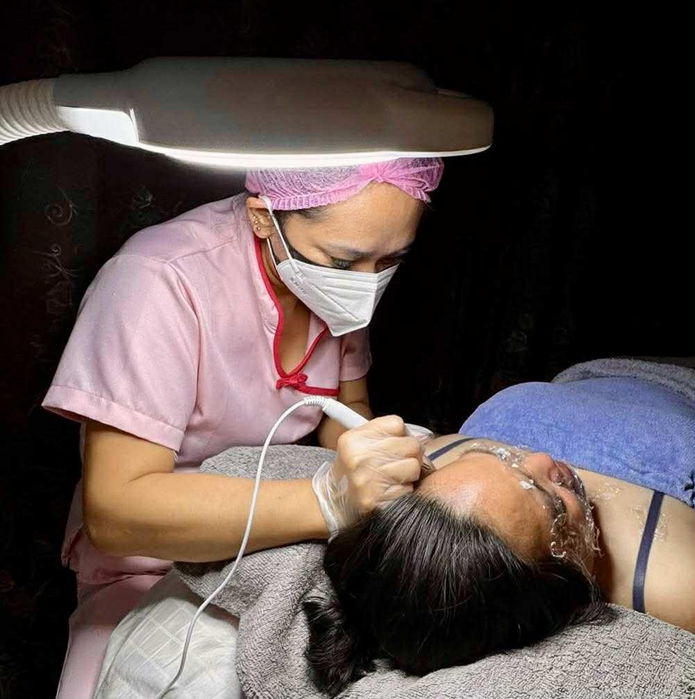 Warts Removal Per Area: Milia, Dot & Flat Warts