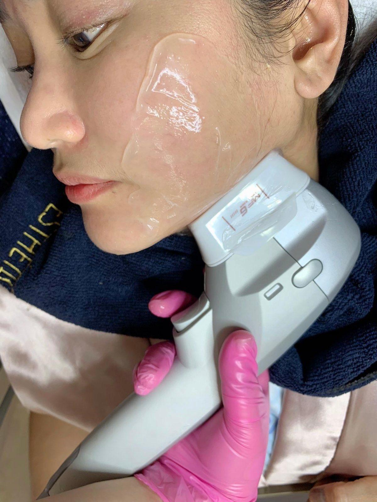 Skinergy Esthetique photo 6